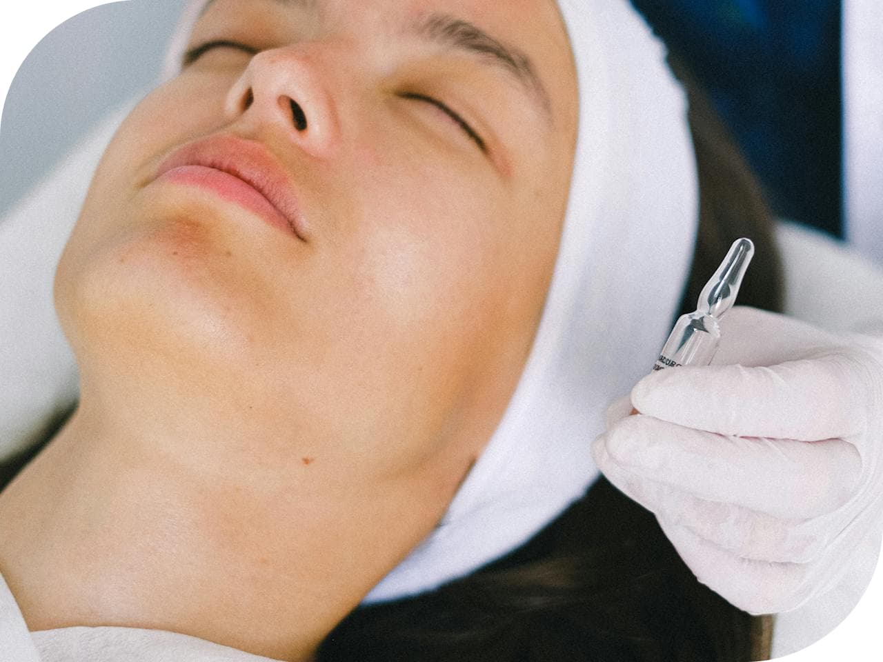 microdermabrasion